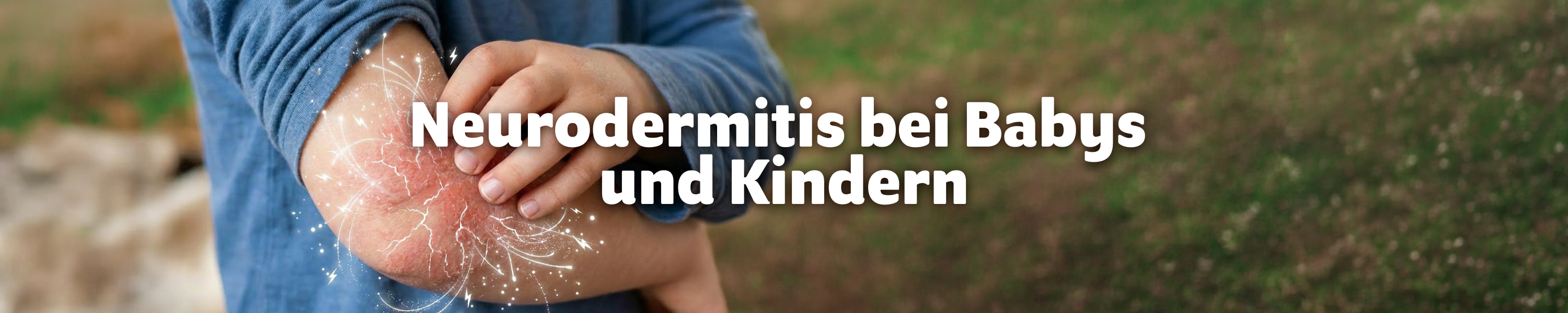 Kind kratzt an einer geröteten, trockenen Hautstelle in der Armbeuge – Symbolbild für Neurodermitis bei Babys und Kindern.